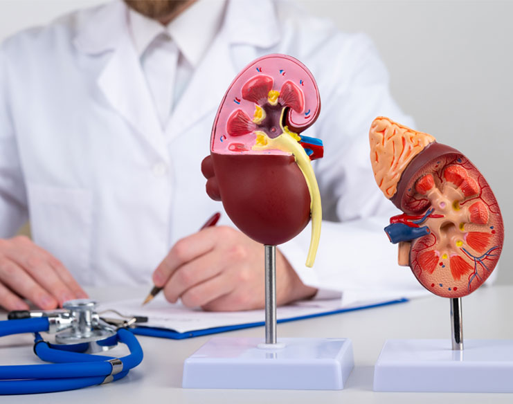 How Are Kidney Stones Diagnosed?