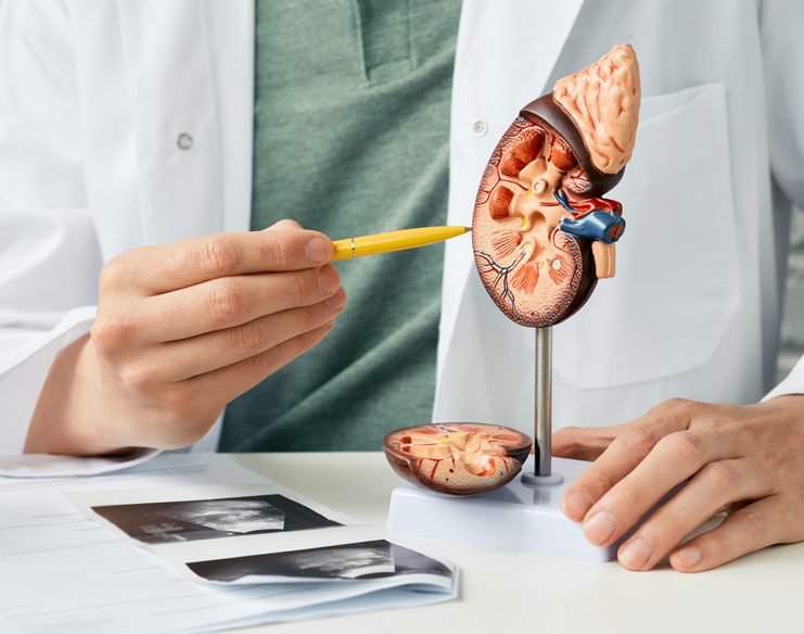 What Are the Different Types of Kidney Stones?